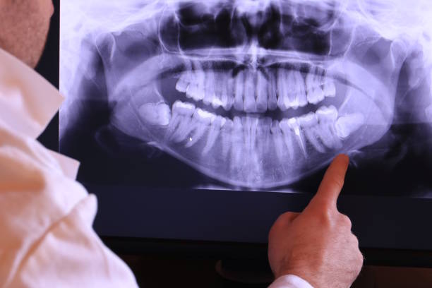 Best Emergency Dental Services for Seniors in Belleville, MI